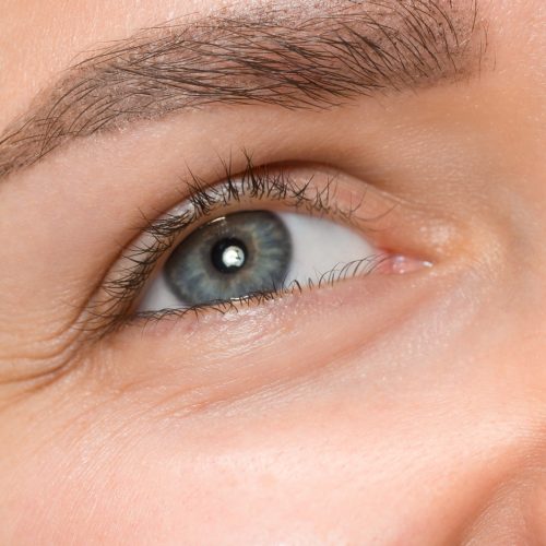 blefaroplastia